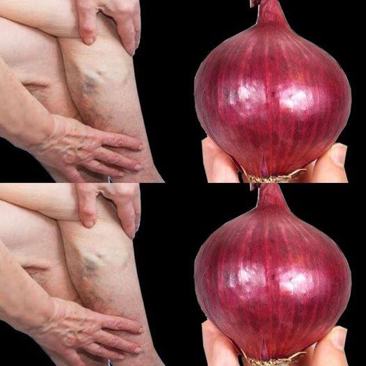 Veins Garlic Redmy (1)