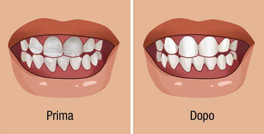 8 Superalimenti Denti (1)