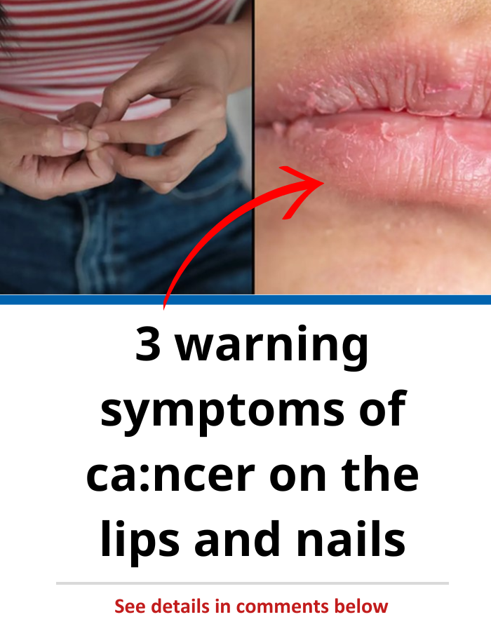 3 Warning Symptoms Of Cancer On The Lips And Nails
